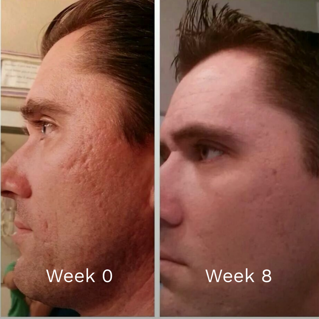 GHK-Cu Copper Peptide Repair Serum