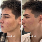 GHK-Cu Copper Peptide Repair Serum